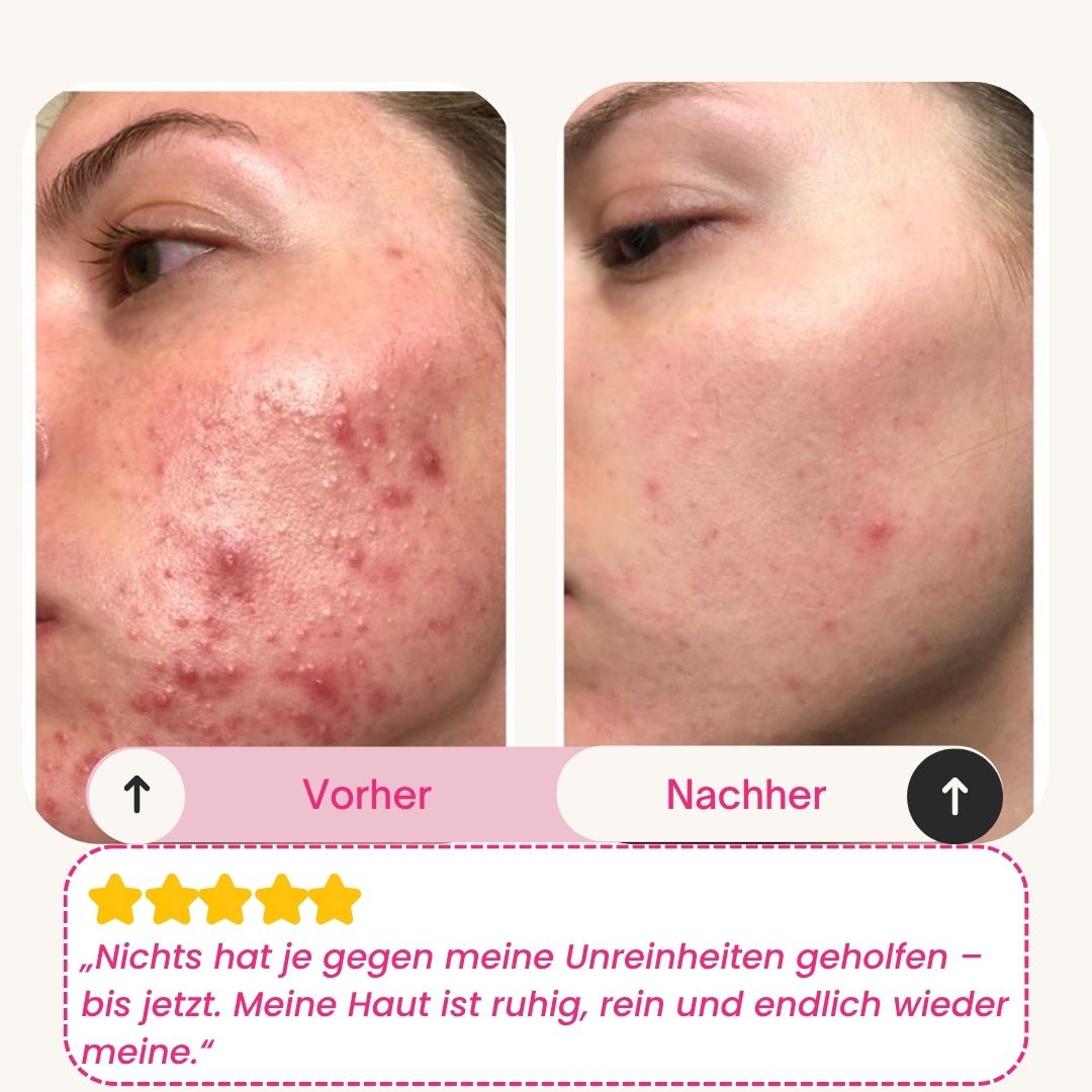 Skinly Bio-Kollagen Maske (5 Masken)