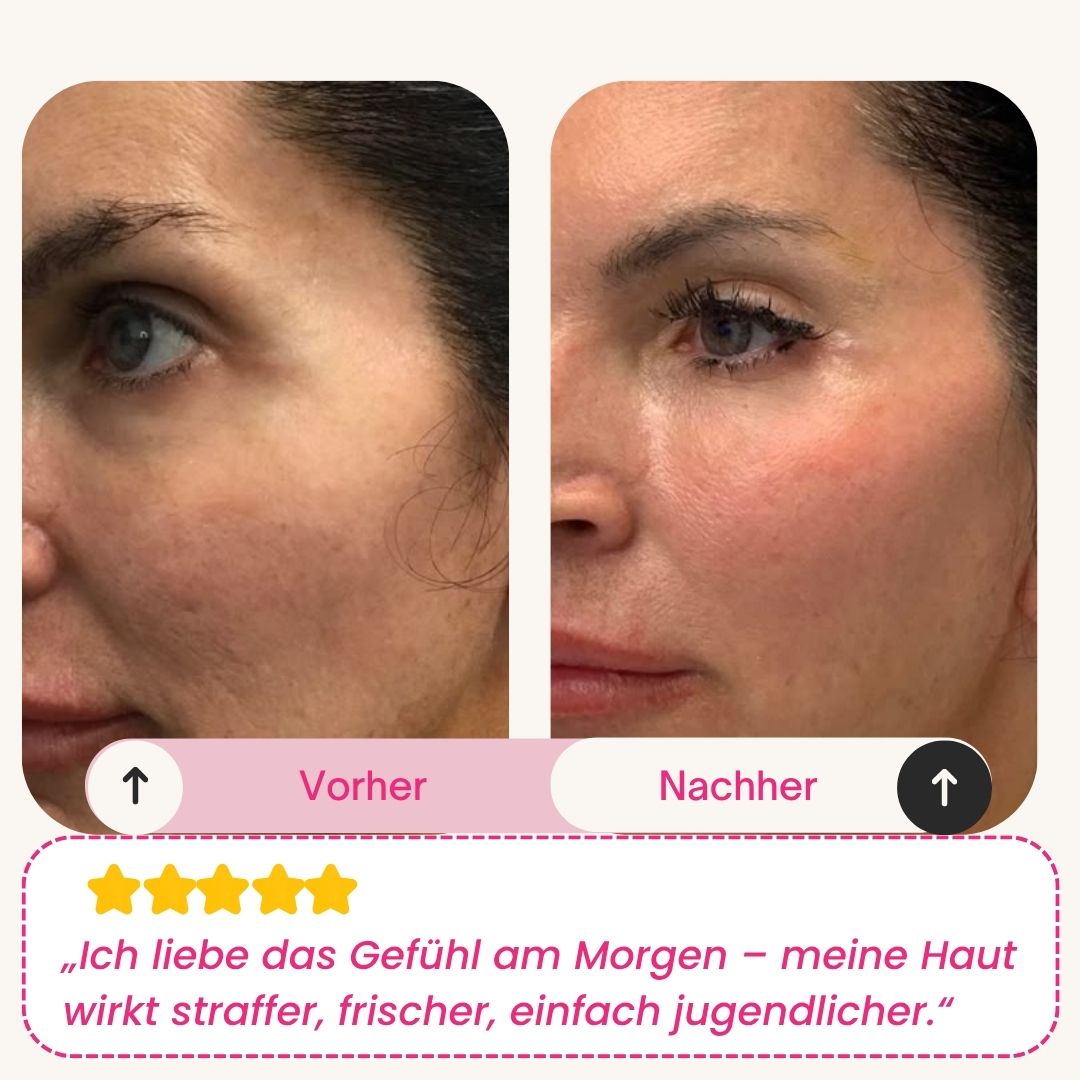 Skinly - Bio-Kollagen Maske