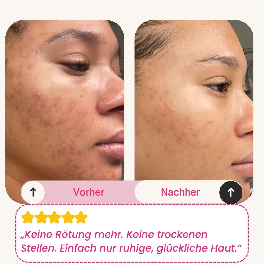 Skinly Bio-Kollagen Maske (5 Masken)
