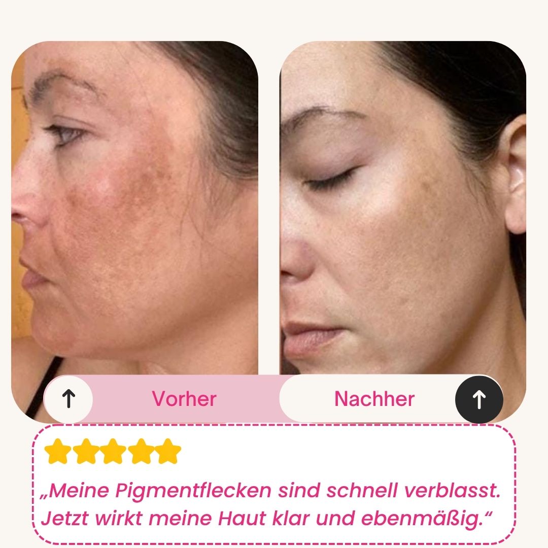 Skinly Bio-Kollagen Maske (5 Masken)