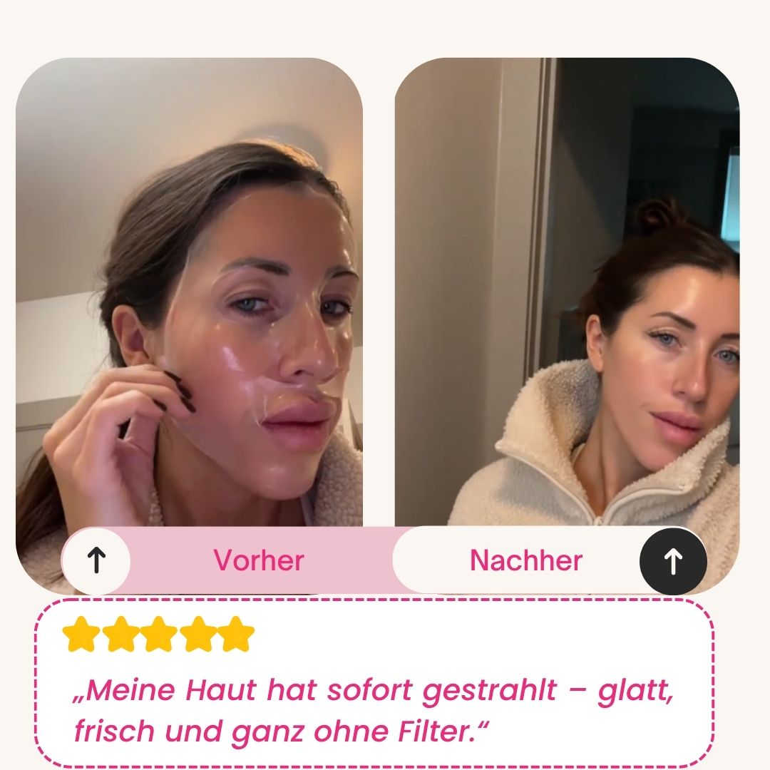 Skinly - Bio-Kollagen Maske