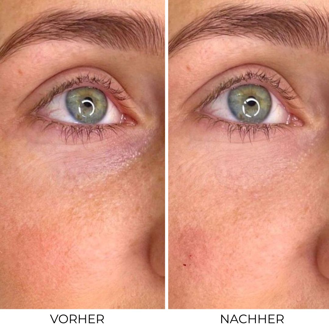 Bloom - (4 Packungen)
