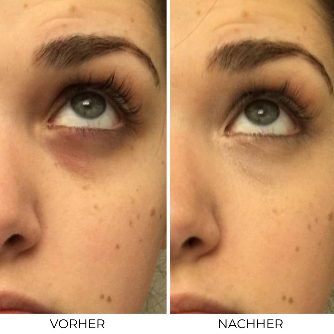 Bloom - (4 Packungen)