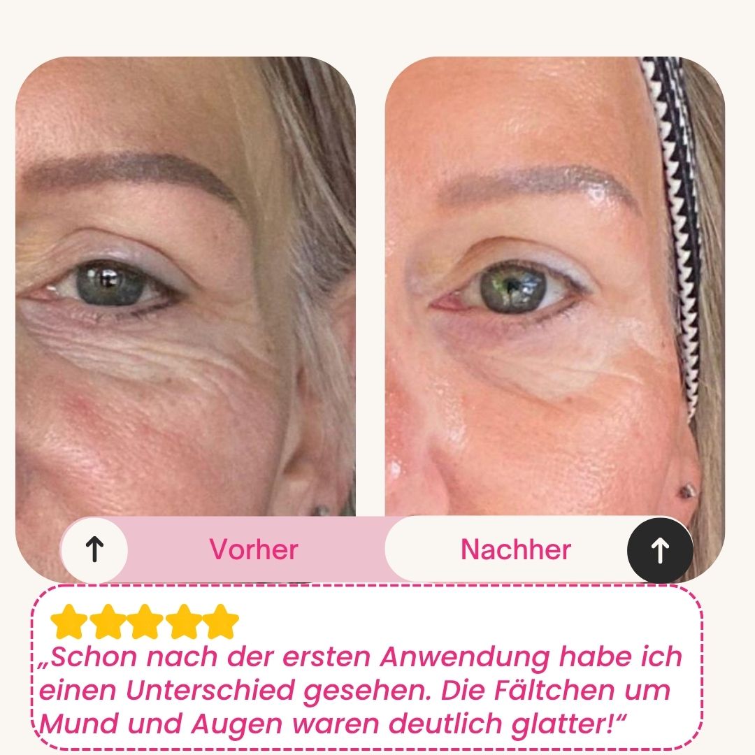 Skinly Bio-Kollagen Maske (5 Masken)
