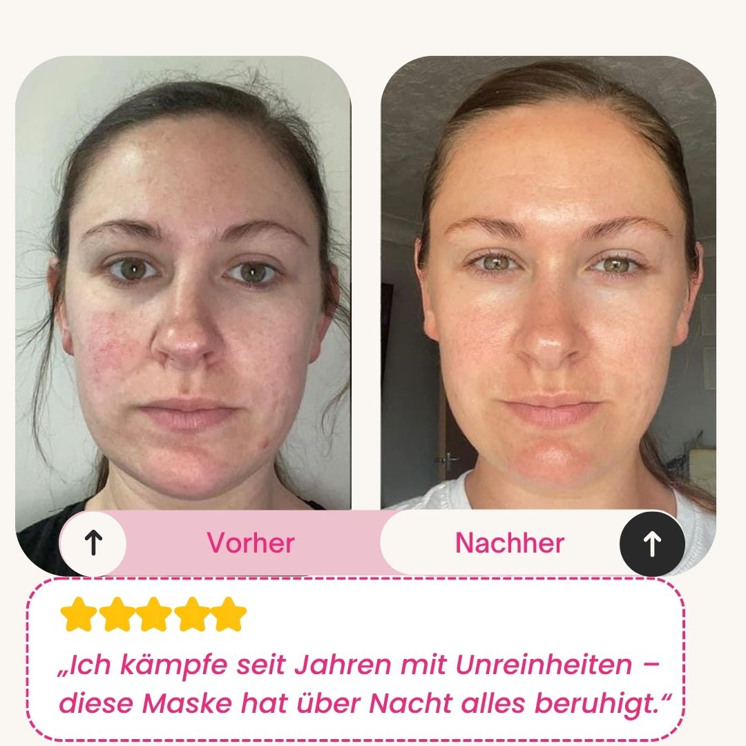 Skinly - Bio-Kollagen Maske