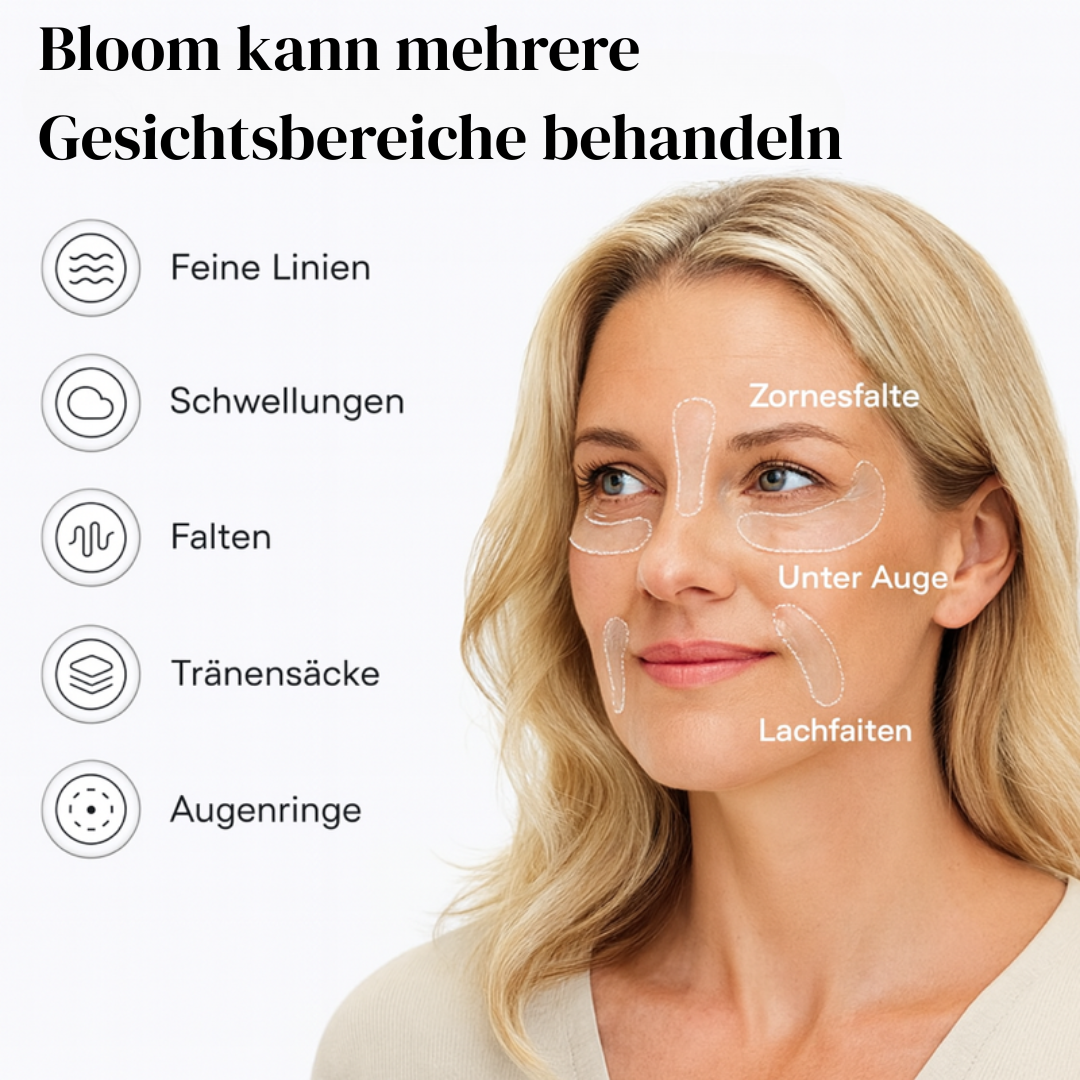Bloom - 4 Packungen